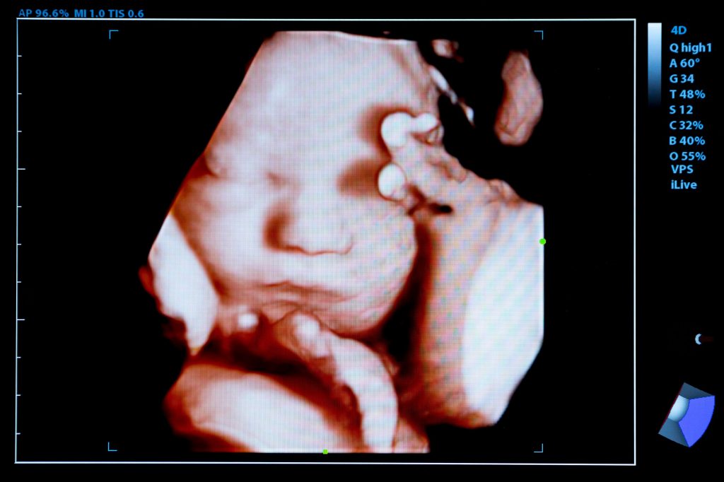 Une échographie 4D montrant clairement le visage d’un bébé in utéro