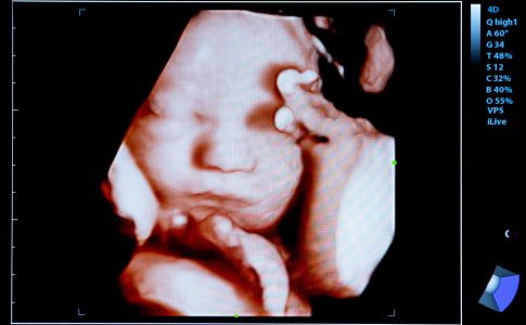 Une échographie 4D montrant clairement le visage d’un bébé in utéro