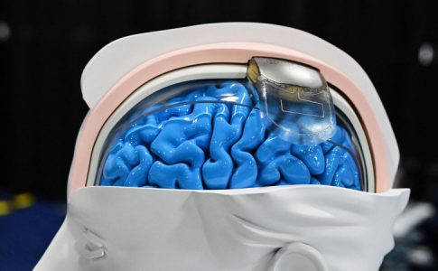 L’image de l’implant cérébral pour personnes paralysées présenté aux CES Las Vegas 2024 