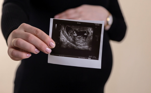 L’échographie d’une femme enceinte, une des rares Françaises maintenant à flot le taux de naissances en France.